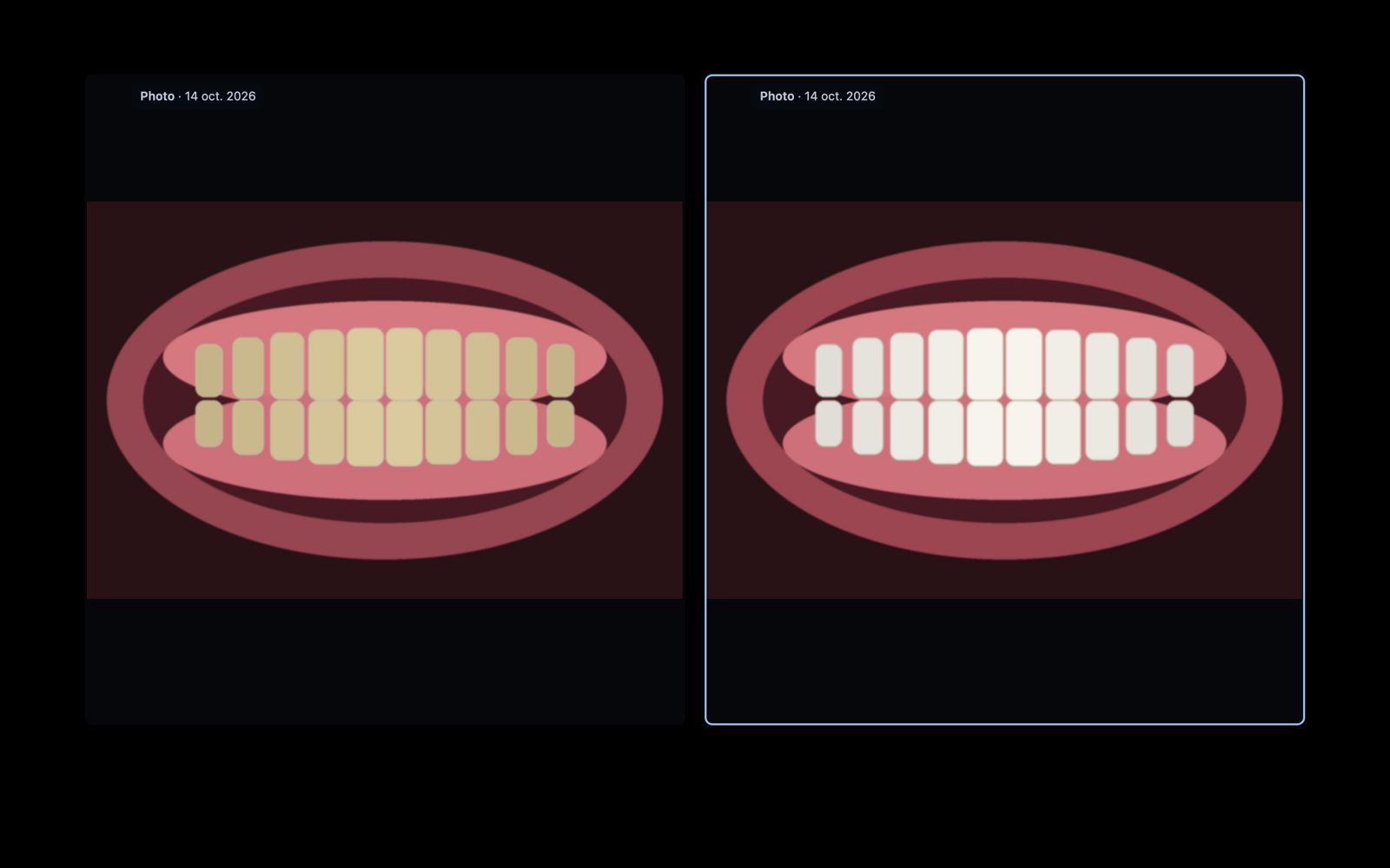 Capture de Samas : Montrer au patient (patient fictif)