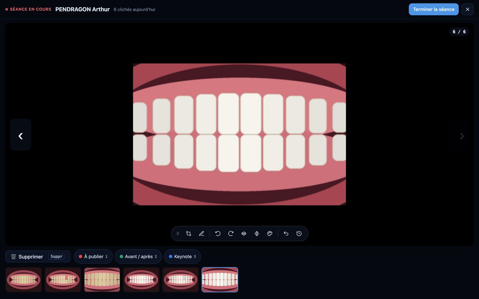 Capture de Samas : Les photos arrivent toutes seules (patient fictif)